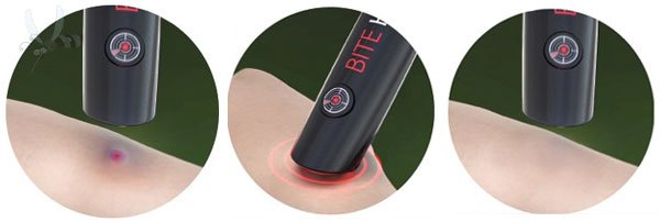 BITE HELP - Likvidátor hmyzích bodnutí a štípanců - přístroj po štípnutí hmyzem 1ks