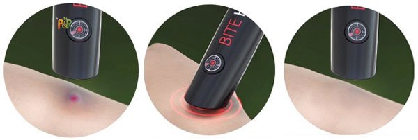 BITE HELP - Likvidátor hmyzích bodnutí a štípanců - přístroj po štípnutí hmyzem 1ks