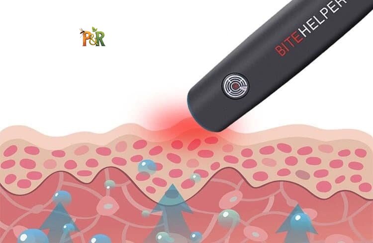 BITE HELP - Likvidátor hmyzích bodnutí a štípanců - přístroj po štípnutí hmyzem 1ks